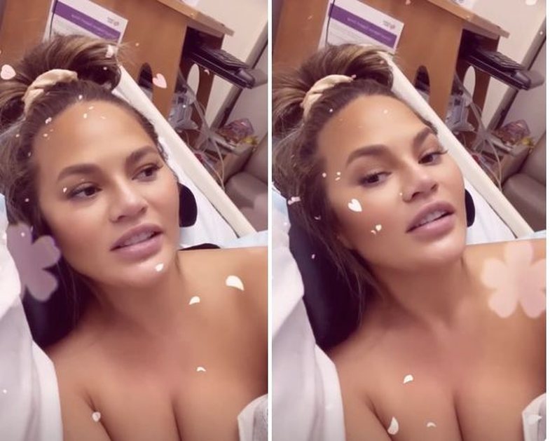 Chrissy Teigen rrëfen problemet e shtatzënisë së 3-të: