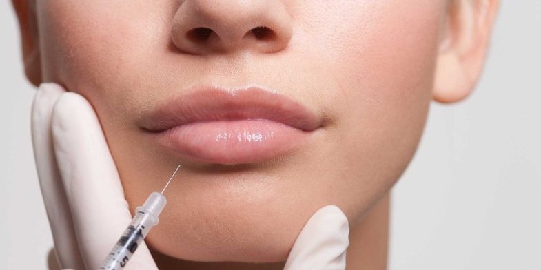 Vajzat po bëjnë 'lip fillers' (mbushës buzësh)