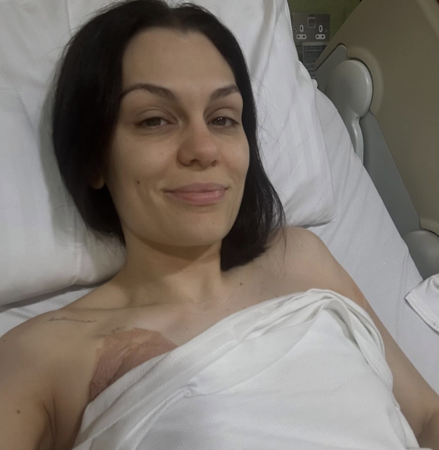 Pas diagnostikimit me kancer, Jessie J tregon se ka bërë operacion