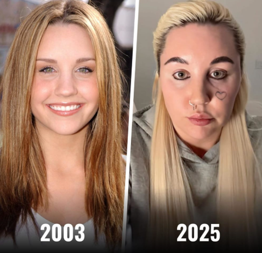 Dikur yll i filmave komedi - Ç'ka ndodhur me Amanda Bynes?