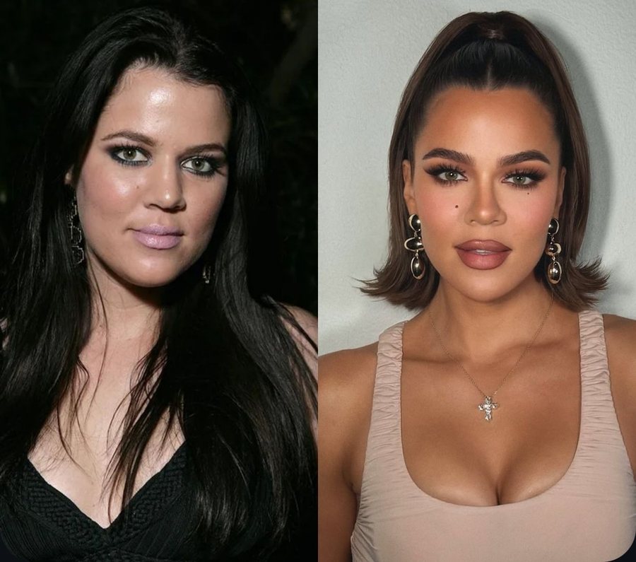 Nga fillerat te sperma e salmonit: Khloé Kardashian s’la më