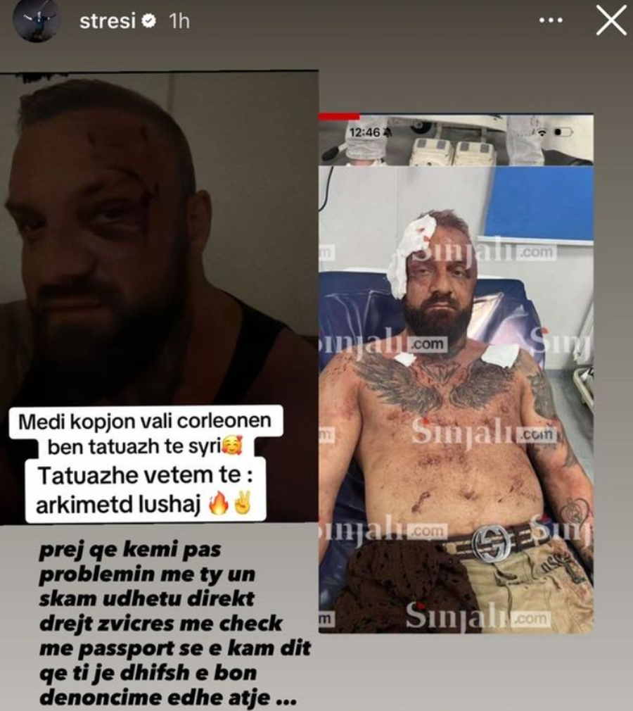 Arrestimi i Noizy-t: Si përfundoi sherri i vitit të kaluar në