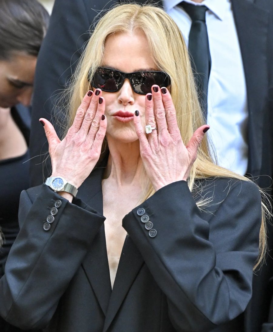 Nicole Kidman thyen rregullin veror të thonjve, por duket yll