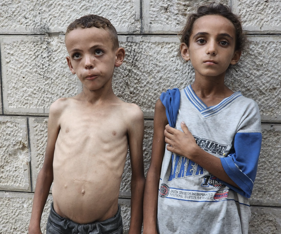 Situata Gaza është tejet alarmante: Vendi nuk ka qenë kurrë
