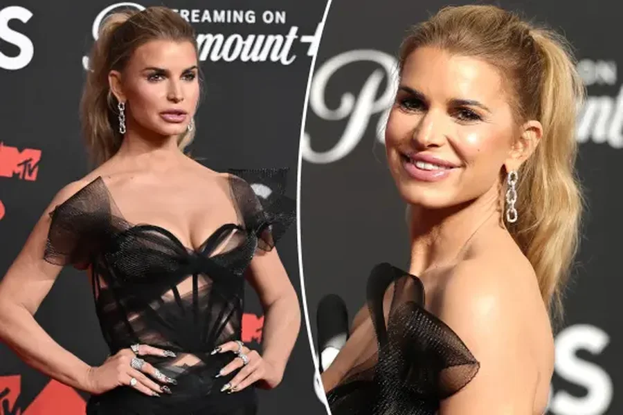 Jessica Simpson habit fansat me fytyrën 'e ngrirë':