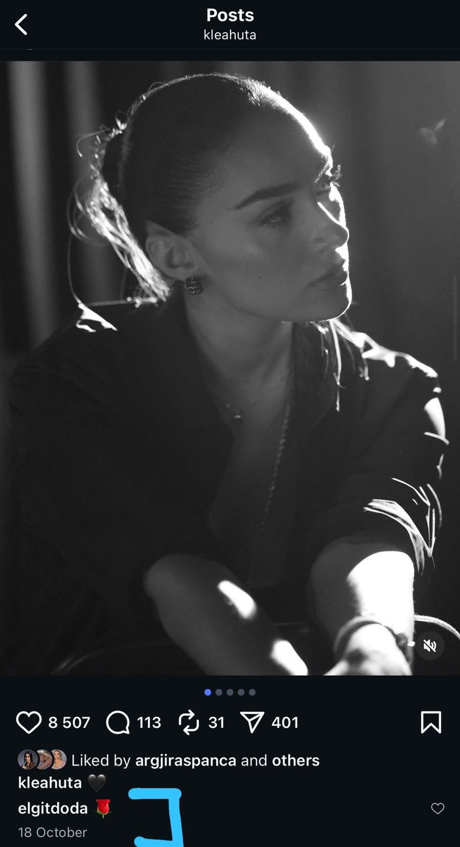 Aludimet se është ndarë nga Elgit Doda: Reagon tërthorazi