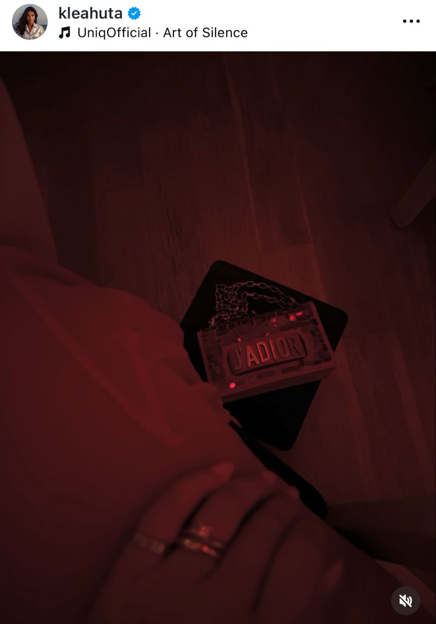 Aludimet se është ndarë nga Elgit Doda: Reagon tërthorazi