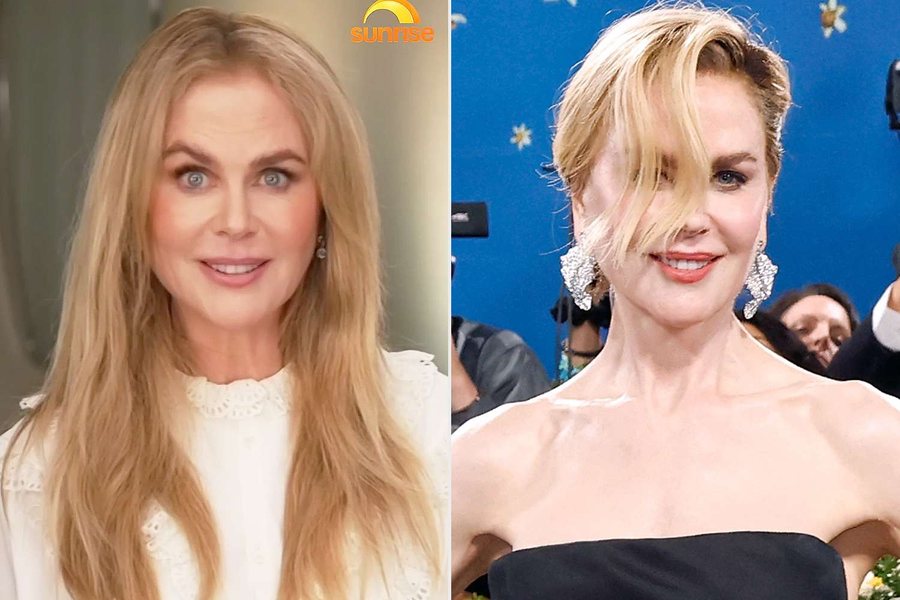 Nicole Kidman heq dorë nga paruket dhe shfaqet pas një kohe *të