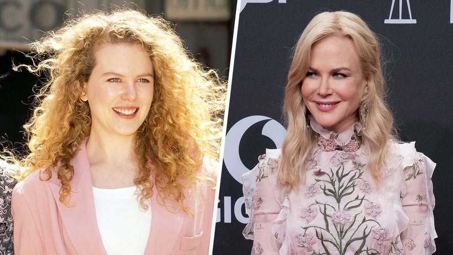 Nicole Kidman heq dorë nga paruket dhe shfaqet pas një kohe *të