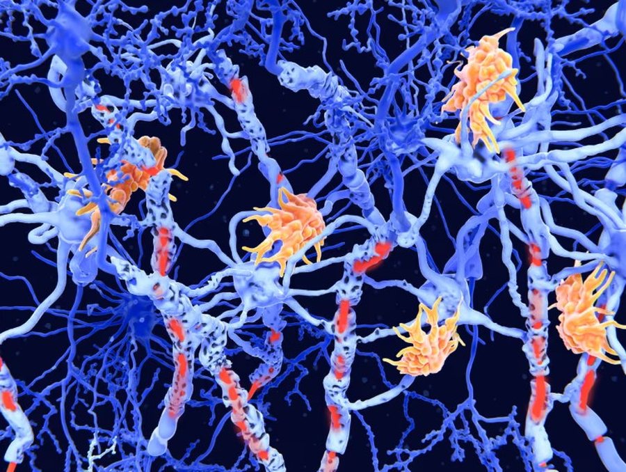 Lajme n&euml; pak minuta: &Ccedil;far&euml; po ndodh n&euml; bot&euml;