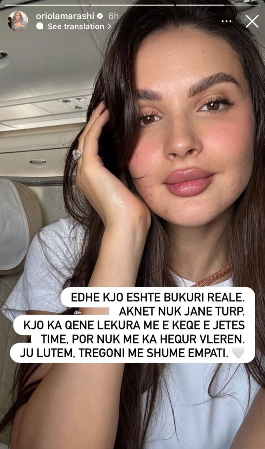 Pa bërë asgjë, Stelina i acaroi shumë, po *shumë*