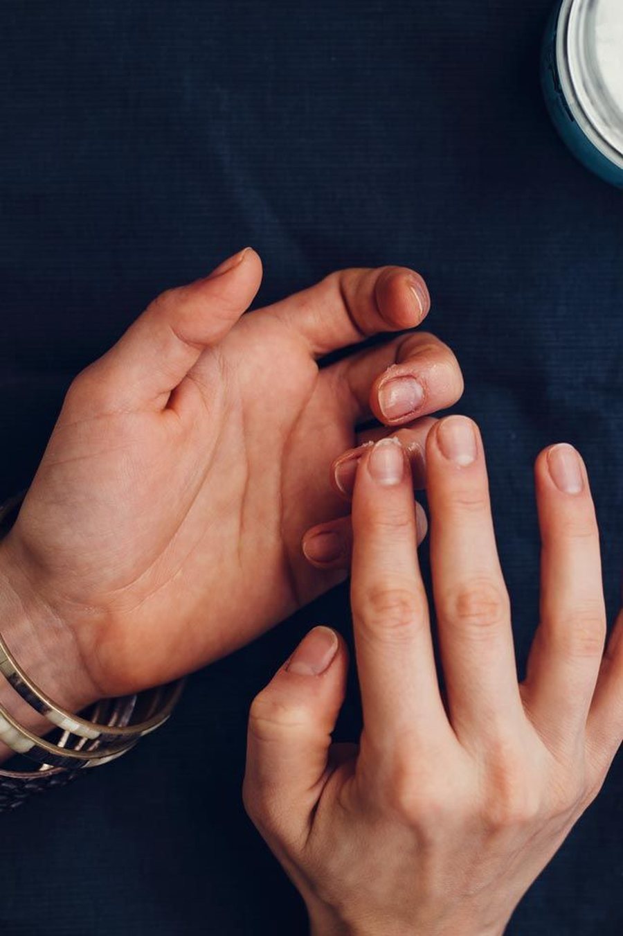 &Ccedil;far&euml; tregojn&euml; k&euml;to 8 shenja te thonjt&euml; p&euml;r