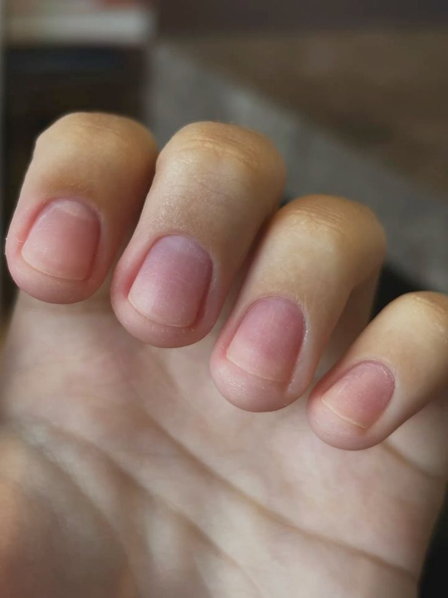 &Ccedil;far&euml; tregojn&euml; k&euml;to 8 shenja te thonjt&euml; p&euml;r