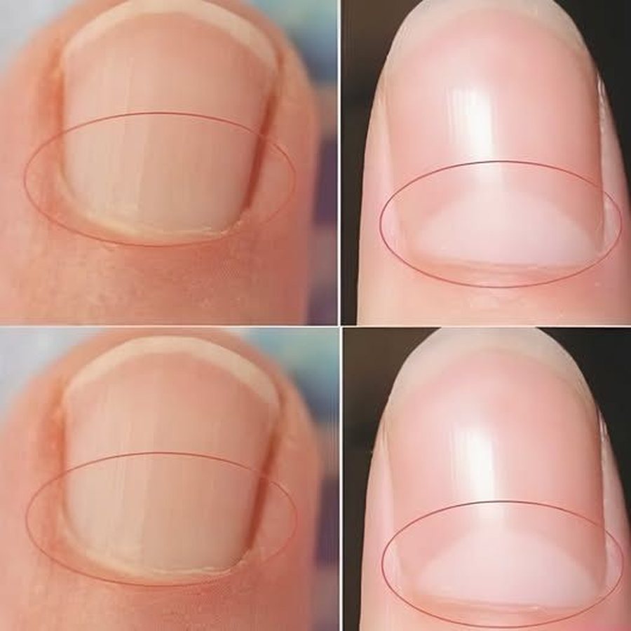 &Ccedil;far&euml; tregojn&euml; k&euml;to 8 shenja te thonjt&euml; p&euml;r