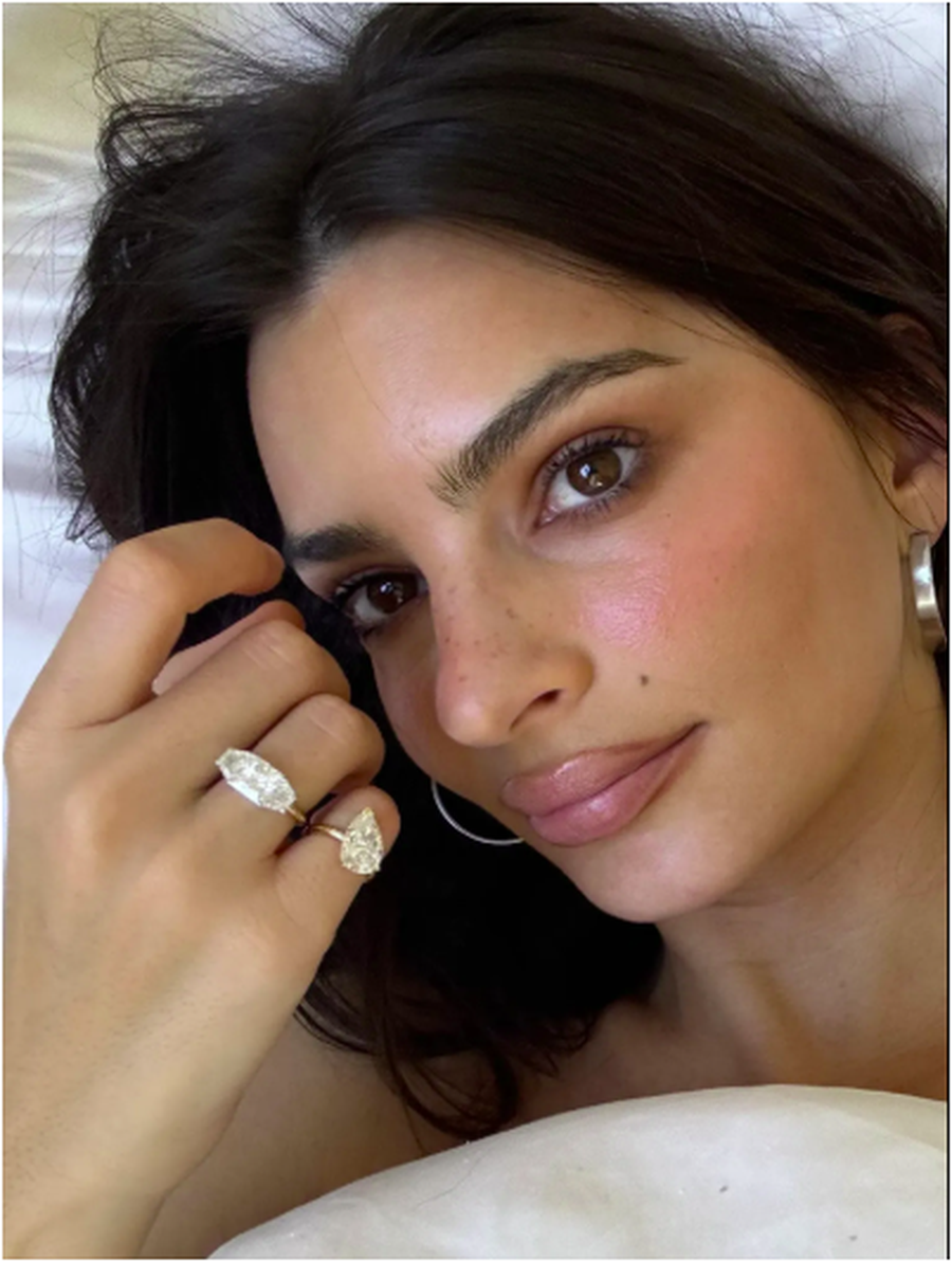 Jo fejes&euml;, jo martes&euml;: Njihuni me unazat e divorcit