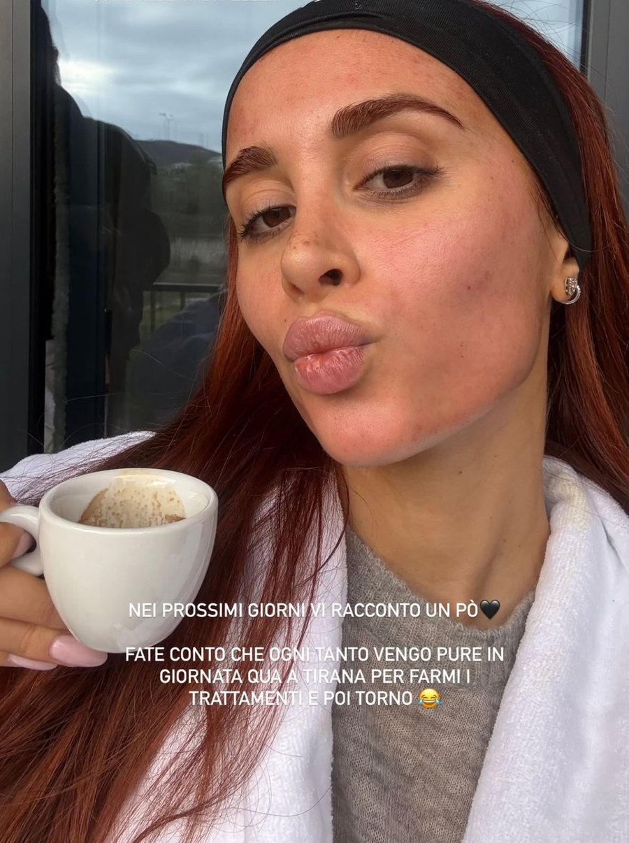 Ndryshimi i look-ut t&euml; Jori Dellit &euml;sht&euml; kaq fiksues: tani duket