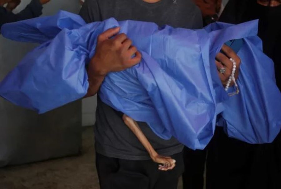 Dhjetëra fëmijë të vdekur nga mungesa e ushqimit, Gaza ka