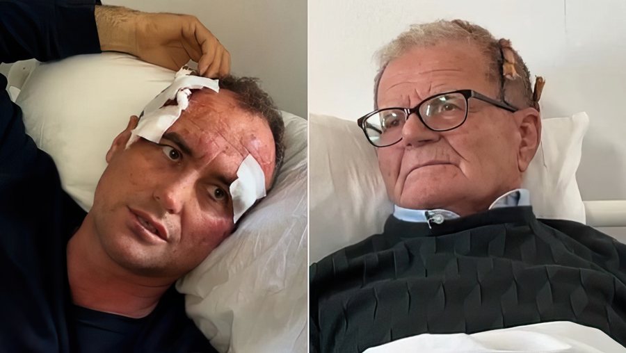 Polici i Fierit b&euml;n p&euml;r spital 46-vje&ccedil;arin: Pse i b&euml;re