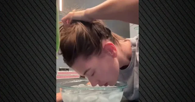 "Banjë me akull për fytyrën"/ Hailey Bieber tregon