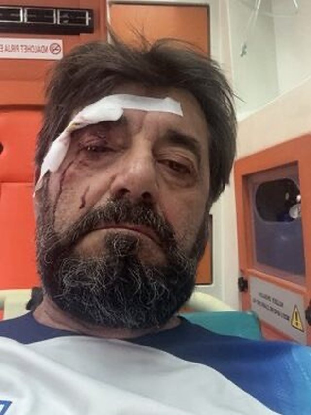 Dhunohet Ilir Demalia, analisti kall&euml;zon n&euml; polici: M&euml; sulmuan dy