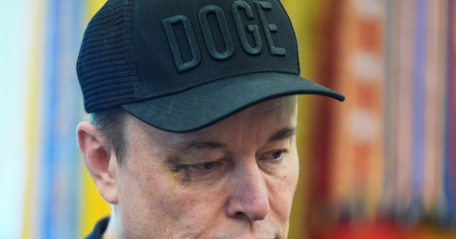 Musk shfaqet me sy të nxirë në konferencën e largimit nga