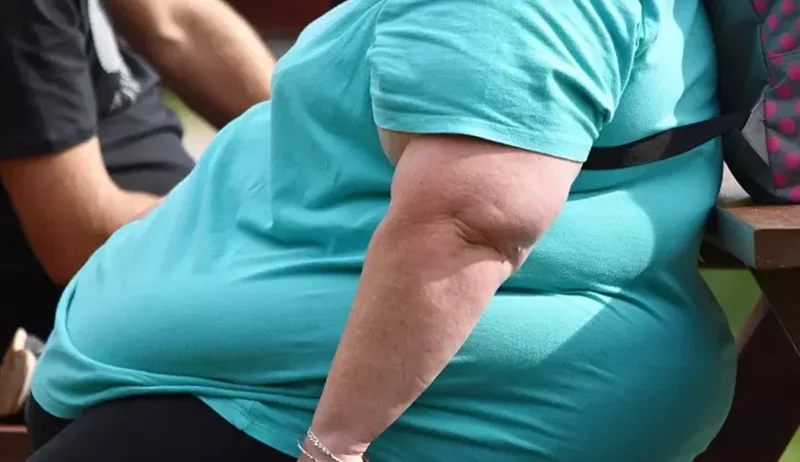 E pazakont&euml;/ 50-vje&ccedil;ari vdes nga pesha e kunatit obez