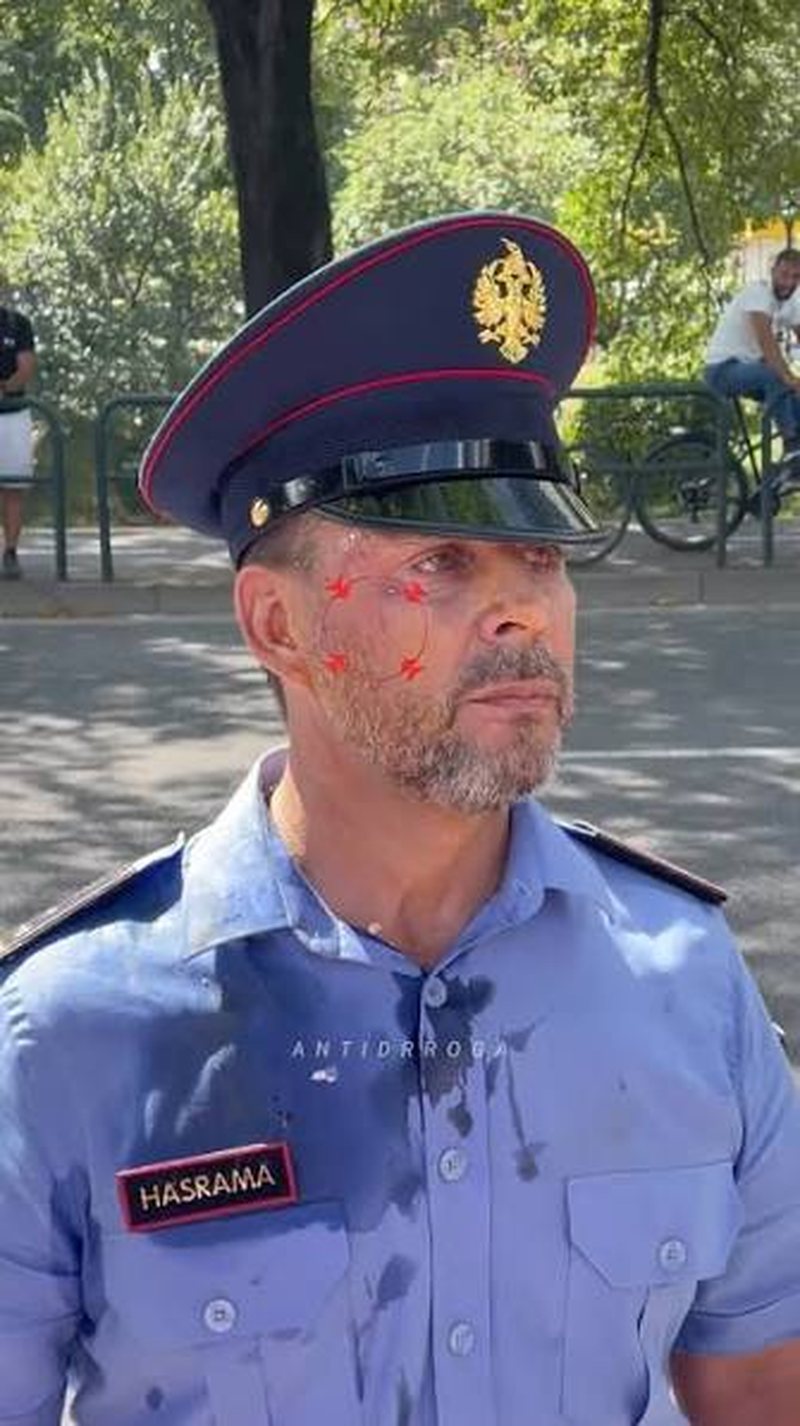&ldquo;Erdhi veza sot ku je, na thuj synin si e ke&rdquo;, protestuesit ironi me