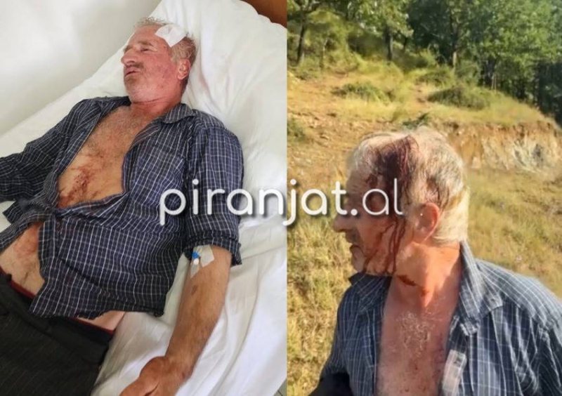FOTOLAJM/ Sherri mes fqinj&euml;ve n&euml; Tropoj&euml;, 60-vje&ccedil;ari