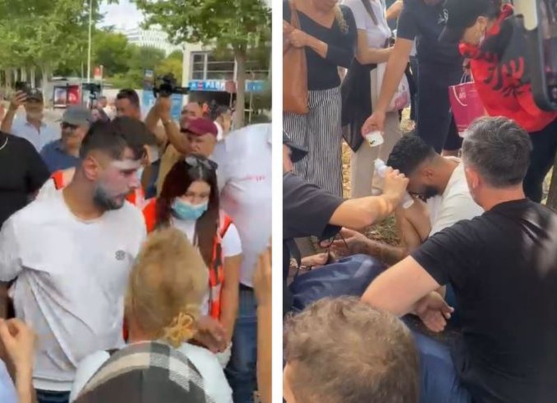 Policia hodhi spraj, i riu shfaq probleme sh&euml;ndet&euml;sore, transportohet