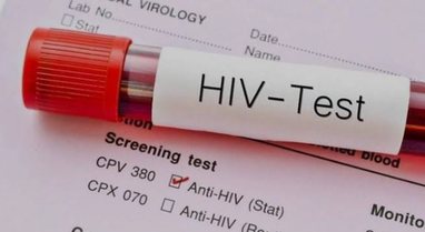HIV në rritje në Kosovë, shënohen 10 raste të reja