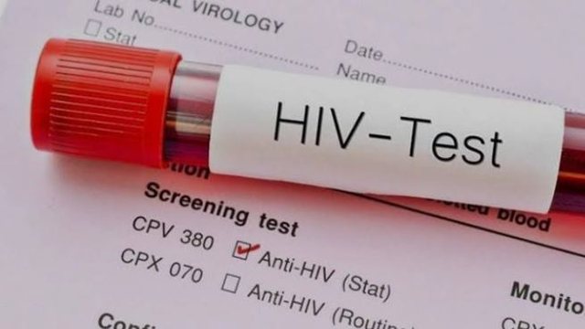 HIV on the rise in Kosovo, 10 new cases recorded in five months