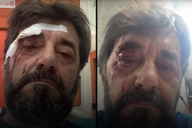 Dhunohet nga dy persona analisti Ilir Demaliaj