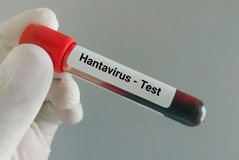 Hantavirus outbreaks continue. How many people have been infected?