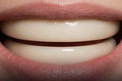 Why are human teeth separated from each other?