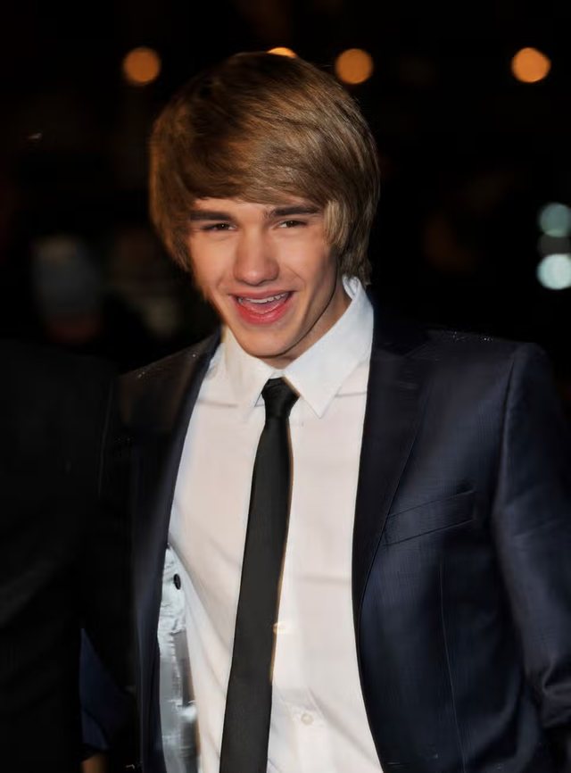 Liam Payne. Një kujtesë se fama në adoleshencë mund të