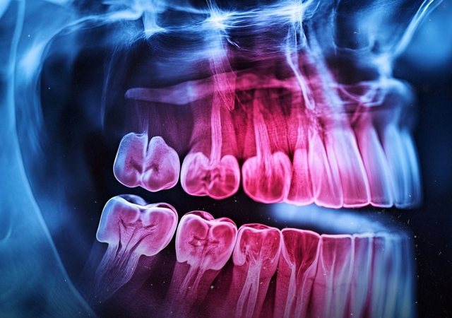 People have a third set of teeth and new medicine could help them emerge