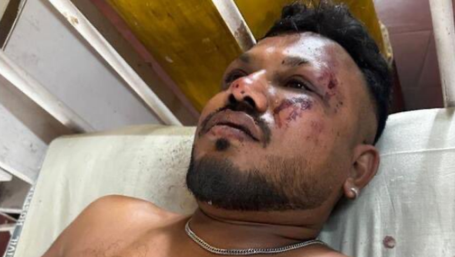 VIDEO+FOTO/ Policia indiane flet për një të mbijetuar që