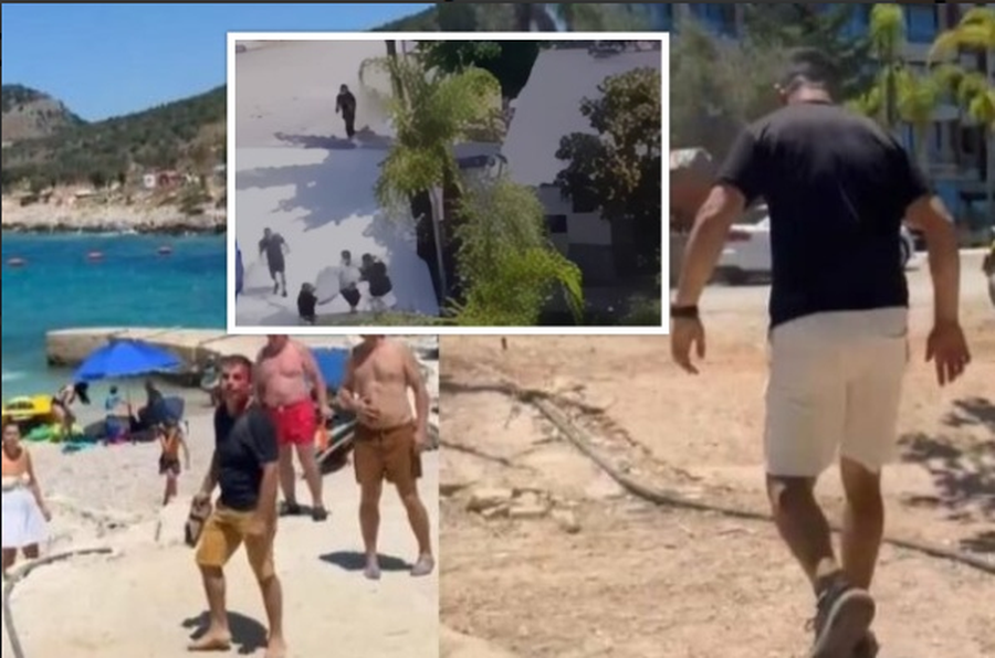 “Plagosje e lehtë”, dhunuan brutalisht 46 vjeçarin