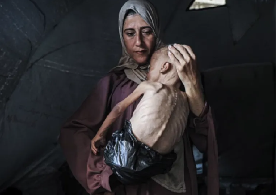 Historia pas fotos së foshnjës së uritur në Gaza që