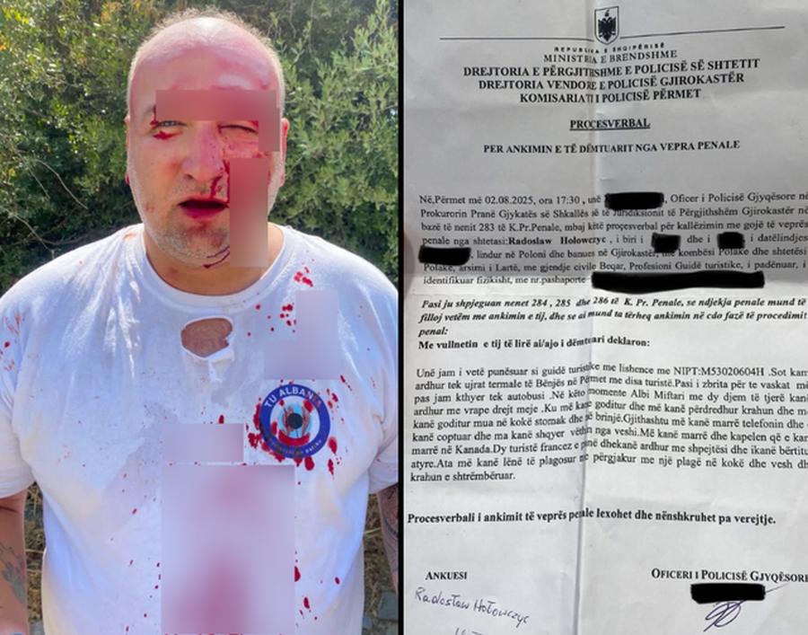 Përmet/ Sulm brutal ndaj operatorit turistik nga Polonia, i dyshuari