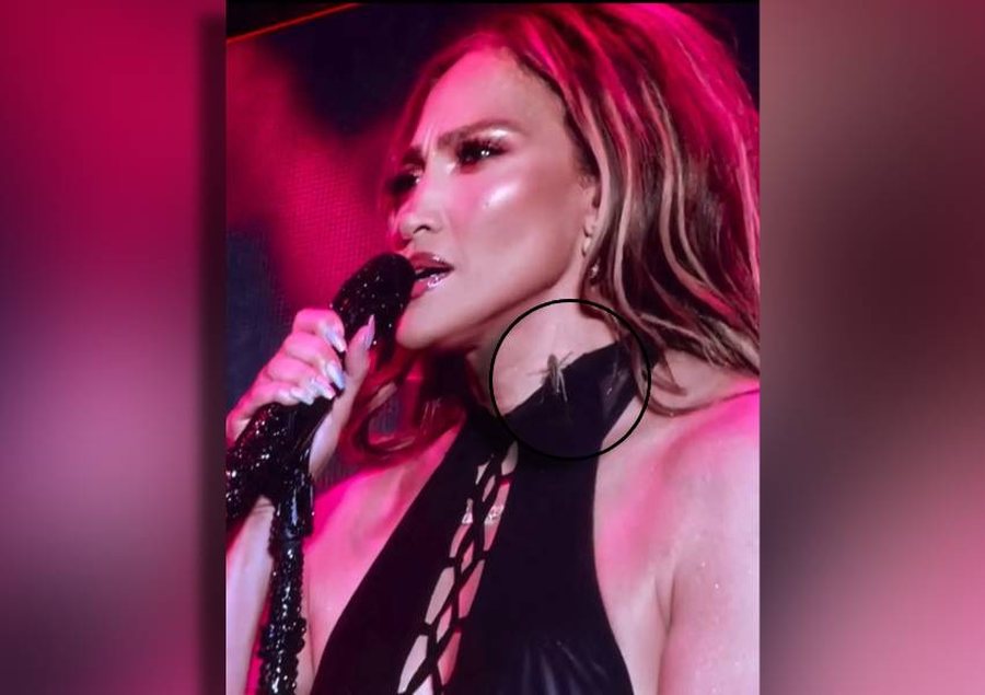VIDEO/ Karkaleci i afrohet te qafa, Jennifer Lopez reagon me qetësi dhe