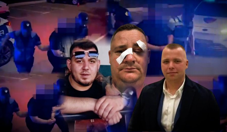 Operacioni te "Komuna e Parisit"/ Prangoset 30-vjeçari me