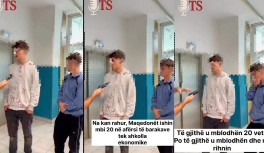 FOTO/ Sulmi i dh*nshëm ndaj 2 nxënësve shqiptarë në