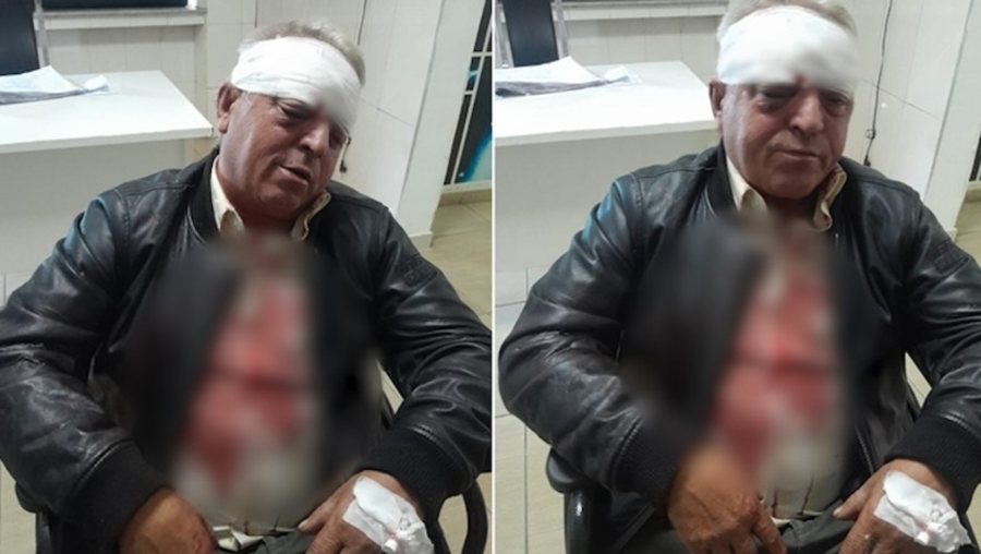 Dh*nohet brutalisht punonjësi i pastrimit në Vlorë,