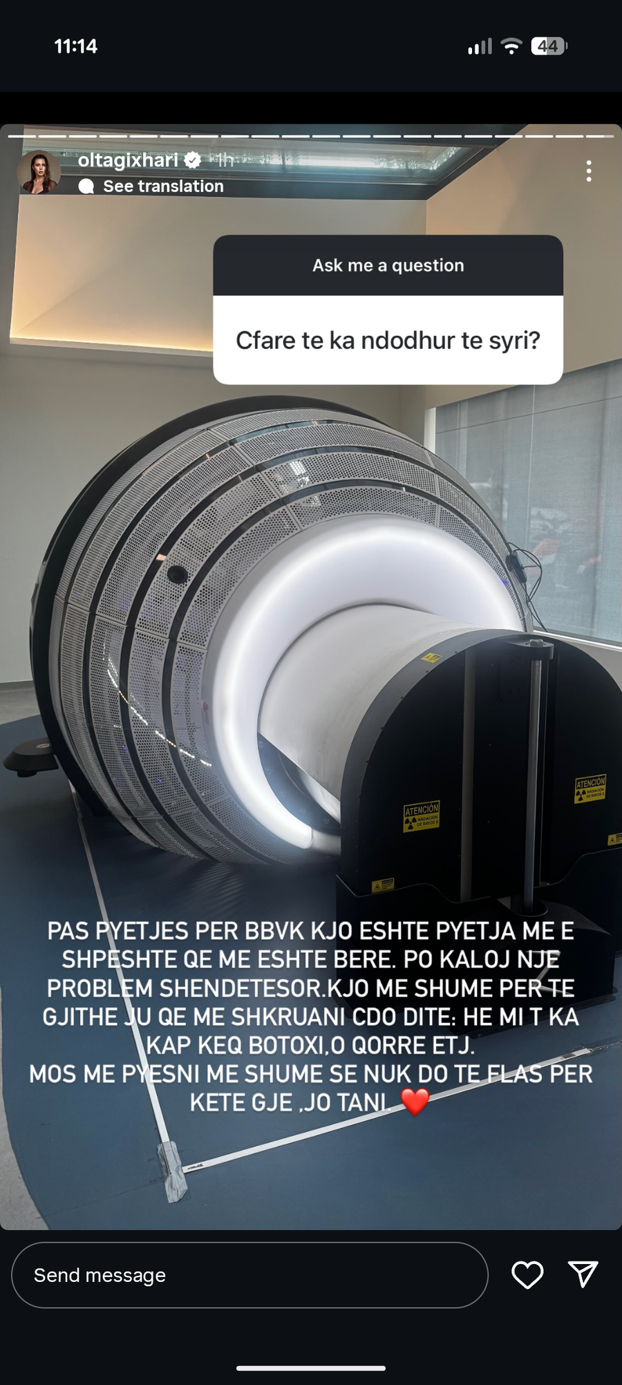 Olta Gixhari shqetëson ndjekësit: Zbulon problemin