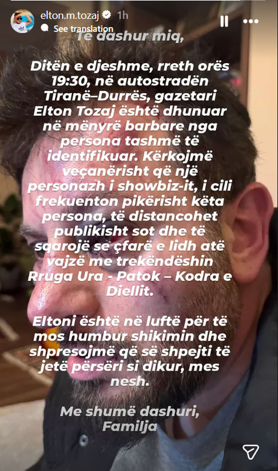 E r&euml;nd&euml; / Dhunohet brutalisht gazetari Elton Tozaj, familjar&euml;t