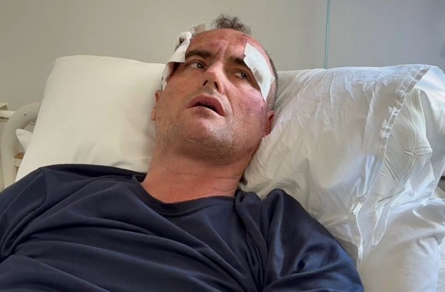 I komplimentoi motr&euml;n n&euml; rrjete sociale, polici i fik dritat e