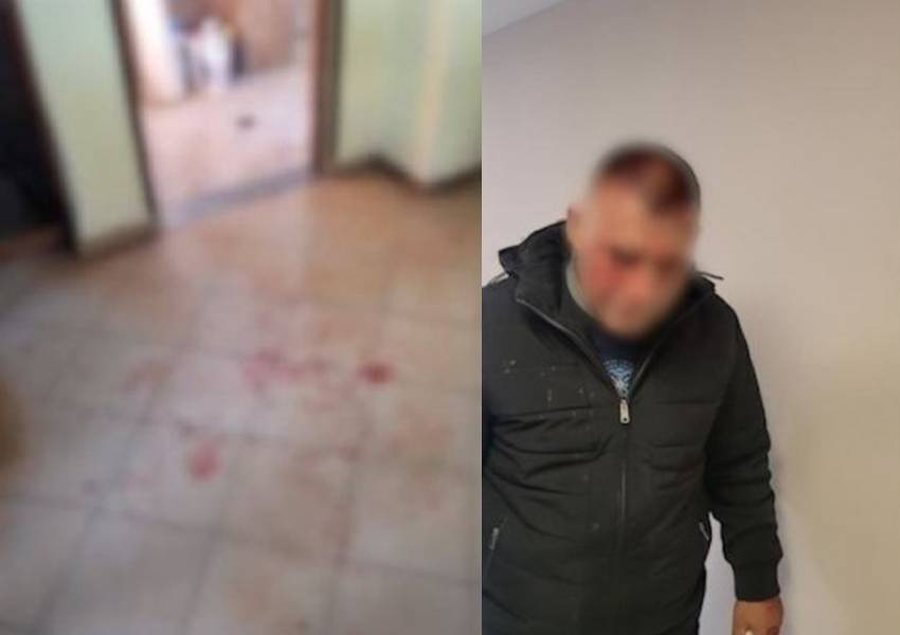 &lsquo;Urdhrin e dha v&euml;llai i ish-deputetit t&euml; PS&rsquo;/ Zbardhen