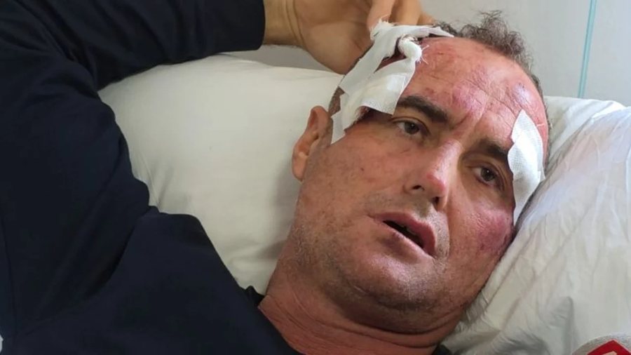 'T&euml; d&euml;shiroj si i &ccedil;mendur Fize', tha se e rrah&euml;n