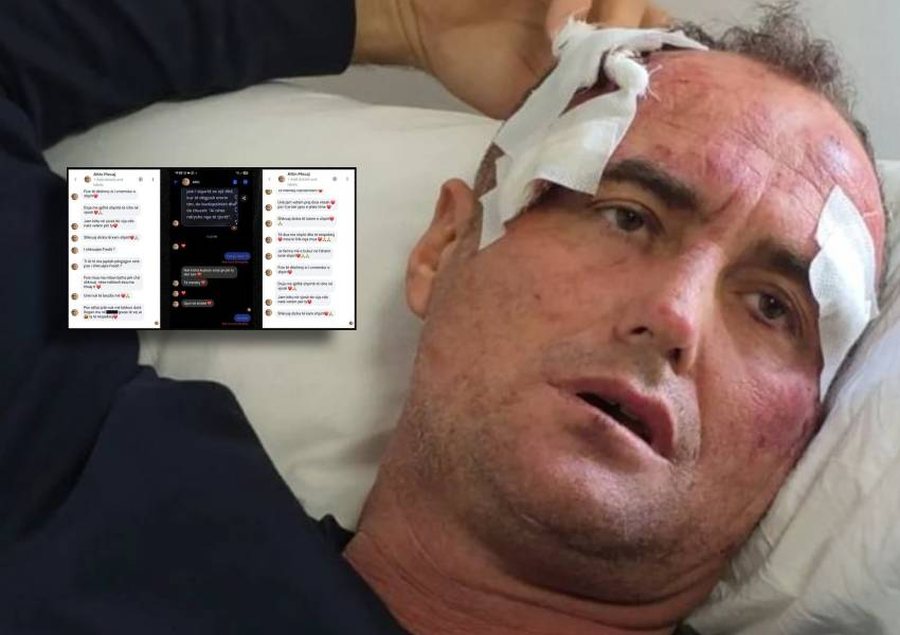 'T&euml; d&euml;shiroj si i &ccedil;mendur Fize'/ Pas publikimit